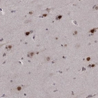 Anti-PSMC2 Antibody