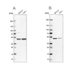 Western blot analysis using Anti-PSMC2 antibody HPA019238 (A) shows similar pattern to independent antibody HPA049621 (B).