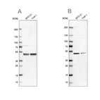 Western blot analysis using Anti-PSMC2 antibody HPA019238 (A) shows similar pattern to independent antibody HPA049621 (B).