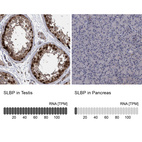 Anti-SLBP Antibody