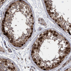 Immunohistochemical staining of human testis shows strong nuclear/cytoplasmic positivity in cells in seminiferous ducts.