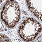 Immunohistochemical staining of human testis shows strong nuclear/cytoplasmic positivity in cells in seminiferous ducts.