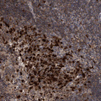 Immunohistochemical staining of human tonsil shows strong nuclear/cytoplasmic positivity in germinal center cells.