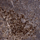 Immunohistochemical staining of human tonsil shows strong nuclear/cytoplasmic positivity in germinal center cells.