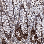 Immunohistochemical staining of human rectum shows strong nuclear/cytoplasmic positivity in glandular cells.