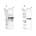 Western blot analysis using Anti-SLBP antibody HPA019254 (A) shows similar pattern to independent antibody HPA061670 (B).