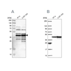 Western blot analysis using Anti-SLBP antibody HPA019254 (A) shows similar pattern to independent antibody HPA061670 (B).