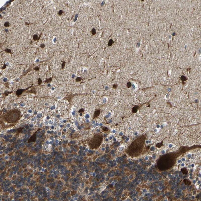 Anti-PPM1E Antibody