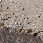 Anti-PPM1E Antibody