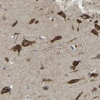 Immunohistochemical staining of human cerebral cortex shows strong cytoplasmic positivity in neurons.