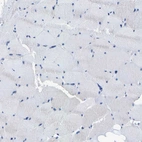 Immunohistochemical staining of human skeletal muscle shows no positivity in myocytes as expected.