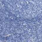 Anti-DSCAM Antibody