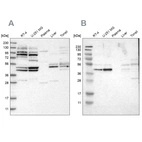 Western blot analysis using Anti-WDR53 antibody HPA019332 (A) shows similar pattern to independent antibody HPA016420 (B).