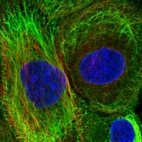 Immunofluorescent staining of human cell line A-431 shows localization to plasma membrane & intermediate filaments.