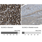 Anti-SLC4A2 Antibody