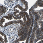 Immunohistochemical staining of human fallopian tube shows strong membranous positivity in glandular cells.
