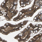 Immunohistochemical staining of human gastrointestinal shows strong membranous positivity in glandular cells.