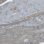 Immunohistochemical staining of human skeletal muscle shows no membranous positivity in myocytes as expected.