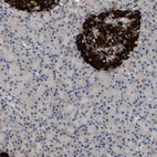 Anti-WDR31 Antibody