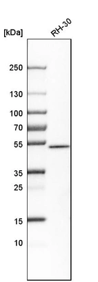Western blot analysis in human cell line RH-30.
