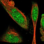 Immunofluorescent staining of human cell line U-251 MG shows localization to nucleus, nucleoli & cytosol.