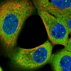 Immunofluorescent staining of human cell line A-431 shows localization to nuclear bodies & cytosol.