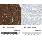 Anti-GDA Antibody