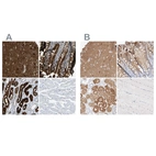 Immunohistochemical staining of human cerebral cortex, duodenum, kidney and skeletal muscle using Anti-GDA antibody HPA019352 (A) shows similar protein distribution across tissues to independent antibody HPA024099 (B).