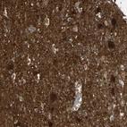 Immunohistochemical staining of human cerebral cortex shows strong cytoplasmic positivity in neurons.