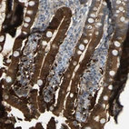 Immunohistochemical staining of human duodenum shows strong cytoplasmic positivity in glandular cells.