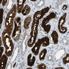 Immunohistochemical staining of human kidney shows strong cytoplasmic positivity in cells in tubules.