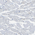 Anti-GDA Antibody