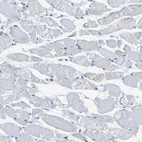 Immunohistochemical staining of human skeletal muscle shows no positivity in myocytes as expected.