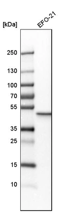 Western blot analysis in human cell line EFO-21.