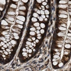 Immunohistochemical staining of human colon using Anti-PPWD1 antibody HPA019353.
