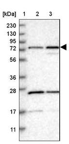 Lane 1: Marker [kDa] 230, 130, 95, 72, 56, 36, 28, 17, 11_br/_Lane 2: Human cell line RT-4_br/_Lane 3: Human cell line U-251MG sp