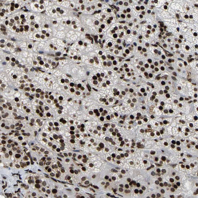 Anti-LRRC61 Antibody