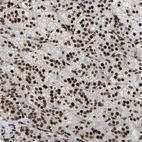 Anti-LRRC61 Antibody