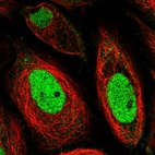 Immunofluorescent staining of human cell line SiHa shows localization to nucleoplasm.