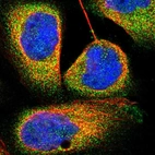 Immunofluorescent staining of human cell line A-431 shows localization to cytosol.