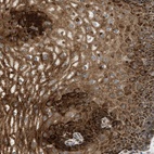 Anti-C7orf43 Antibody