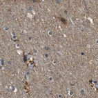 Immunohistochemical staining of human cerebral cortex using Anti-PPWD1 antibody HPA019360.