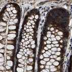 Immunohistochemical staining of human colon using Anti-PPWD1 antibody HPA019360.