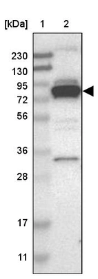 Lane 1: Marker [kDa] 230, 130, 95, 72, 56, 36, 28, 17, 11_br/_Lane 2: Human cell line RT-4