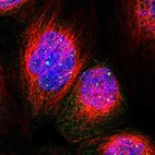 Immunofluorescent staining of human cell line A-431 shows localization to nuclear bodies.
