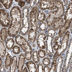 Anti-ARL6 Antibody