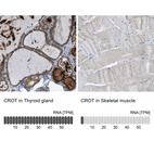 Anti-CROT Antibody