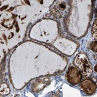 Immunohistochemical staining of human thyroid gland shows high expression.