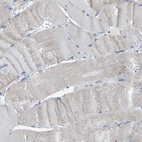 Immunohistochemical staining of human skeletal muscle shows low expression as expected.