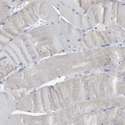 Anti-CROT Antibody